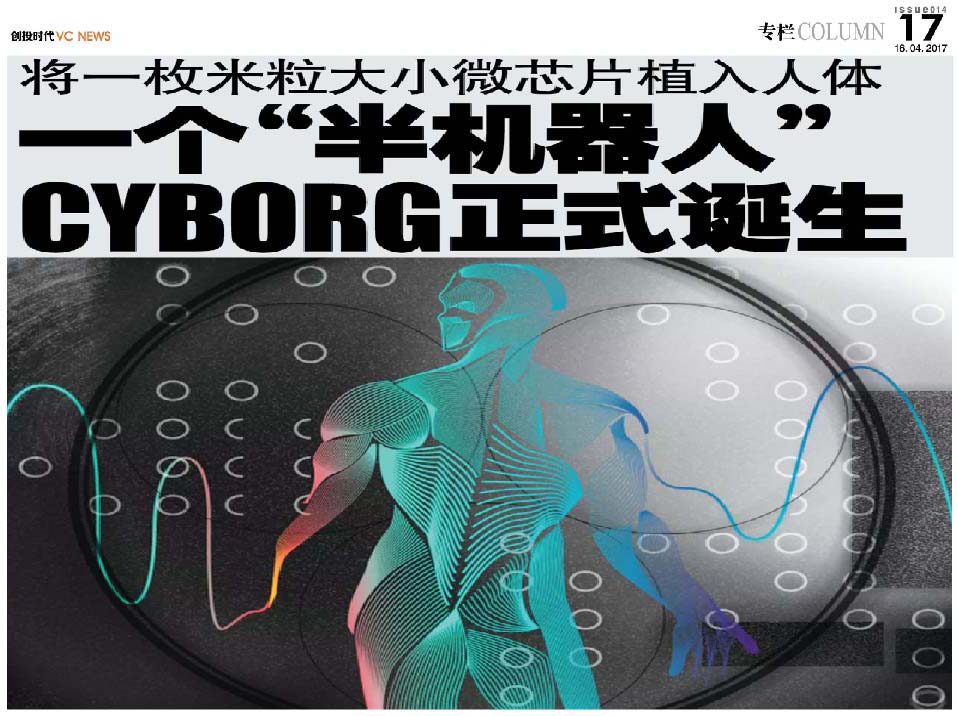 将一枚米粒大小微芯片植入人体 一个“半机器人”（Cyborg）正式诞生